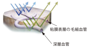 NBI（Narrow Band Imaging）